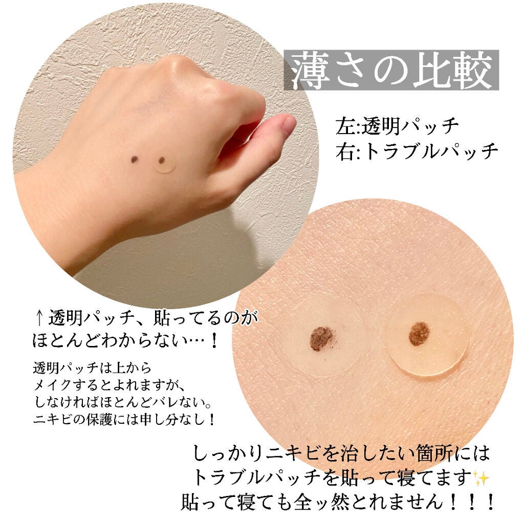 A-zero Shot Trouble Dressing Spot Patch/MEDIHEAL/シートマスク・パックを使ったクチコミ(3枚目)