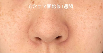 化粧水 敏感肌用 さっぱりタイプ/無印良品/化粧水を使ったクチコミ(1枚目)