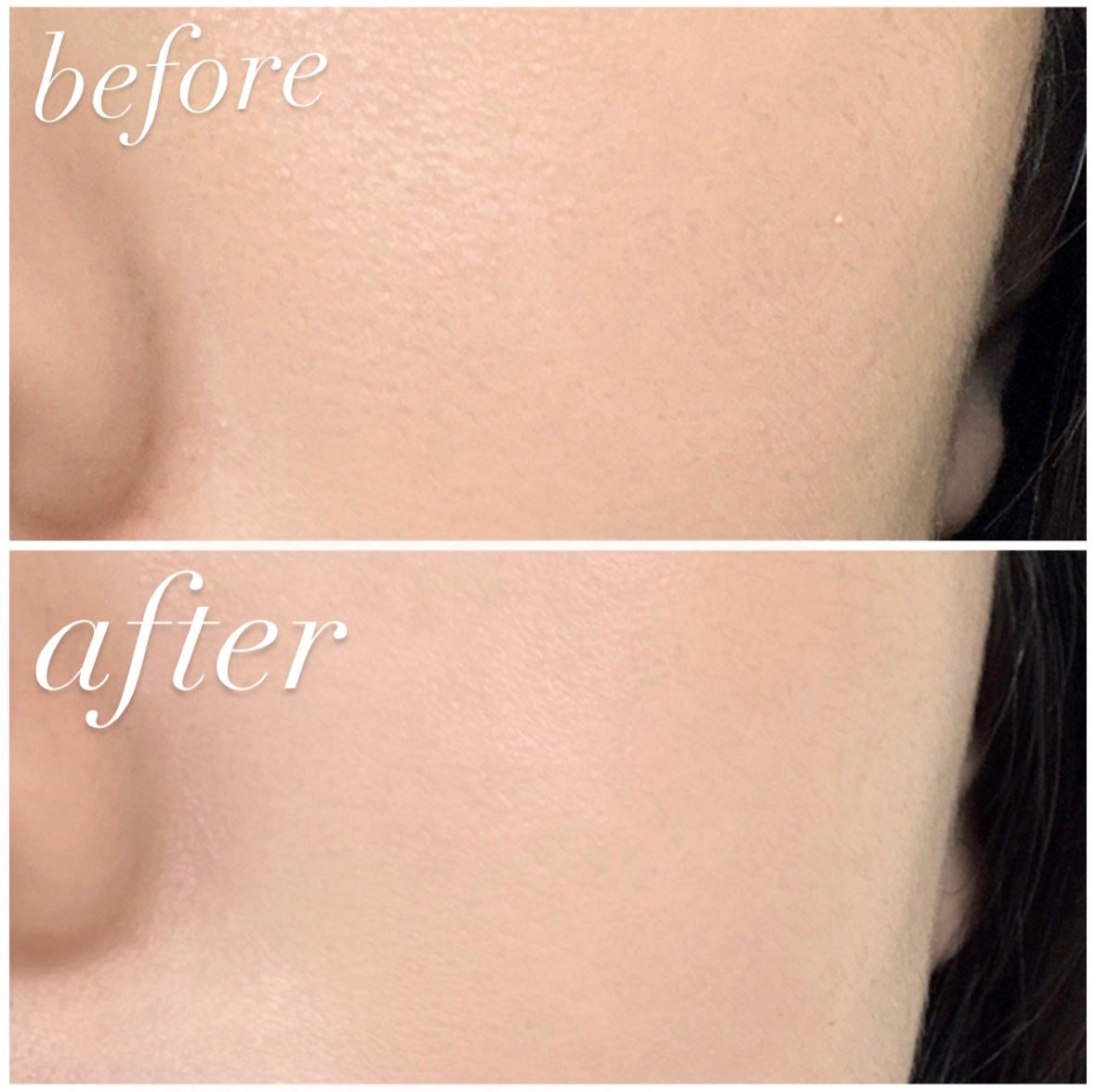 スキンライトセラピーII/Makeon/美顔器・マッサージを使ったクチコミ(3枚目)