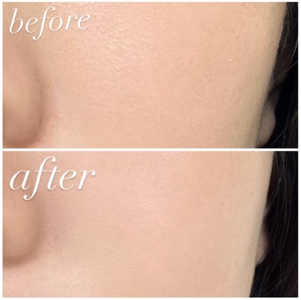 スキンライトセラピーII/Makeon/美顔器・マッサージを使ったクチコミ(3枚目)