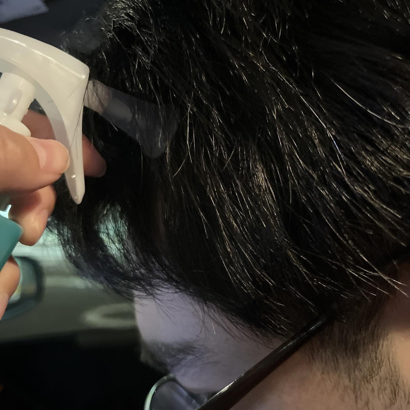 スペシャルケアセット(スキャルプパッチ/育毛トニック)/fasa/頭皮ローションを使ったクチコミ(5枚目)