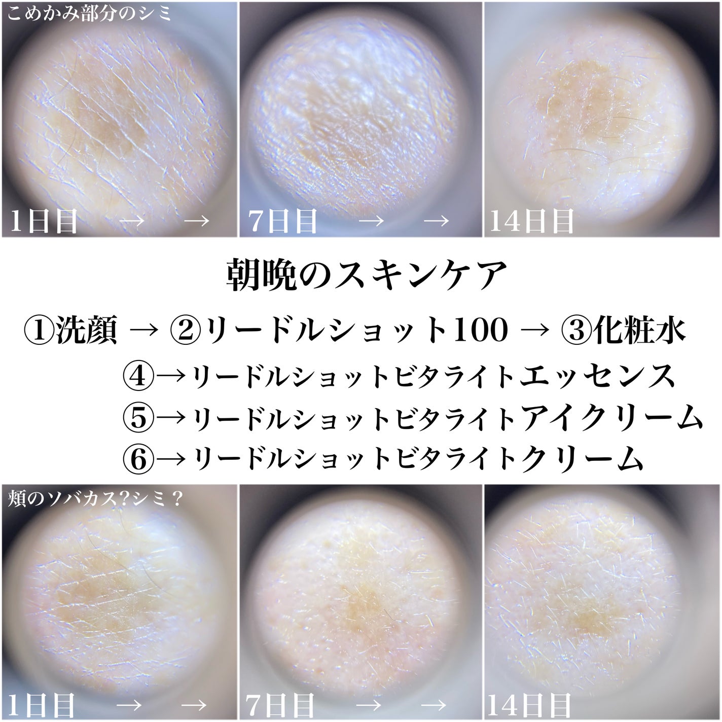 リードルショット100/VT/美容液を使ったクチコミ(2枚目)