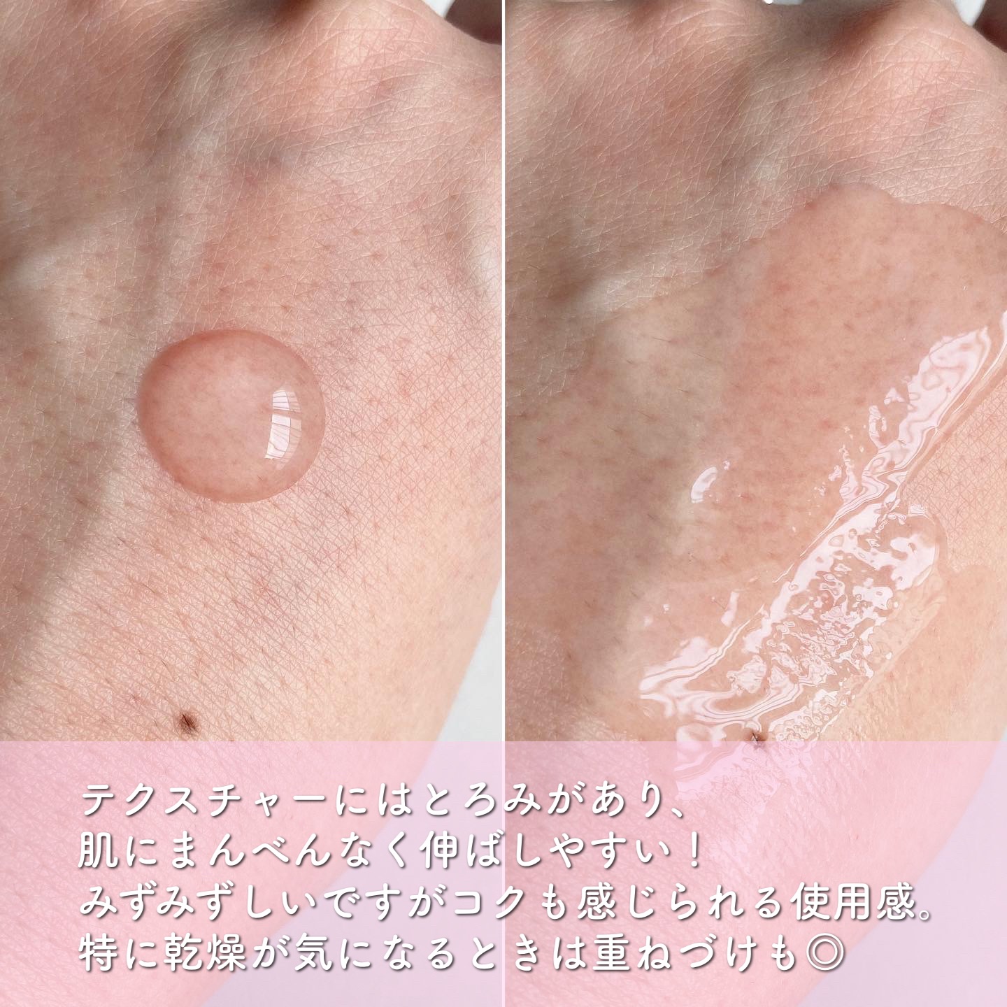 ピンクティーツリーシナジーセラム/APLIN/美容液を使ったクチコミ（2枚目）