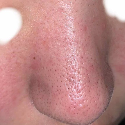 ハトムギ保湿ジェル(ナチュリエ スキンコンディショニングジェル)/ナチュリエ/美容液を使ったクチコミ(2枚目)