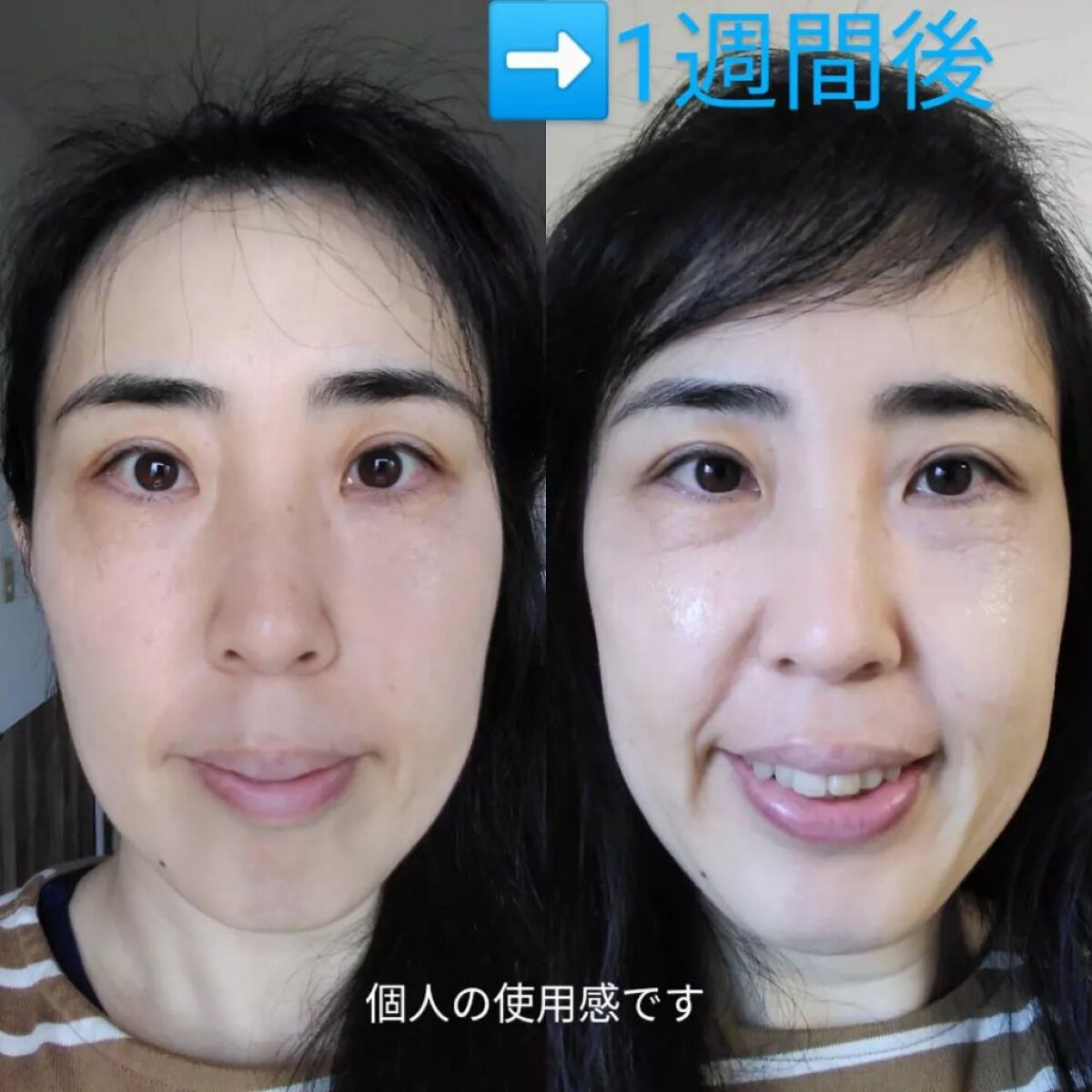 FACE MASK No.201/SKIN FORESTA FACTORY/フェイスクリームを使ったクチコミ(4枚目)