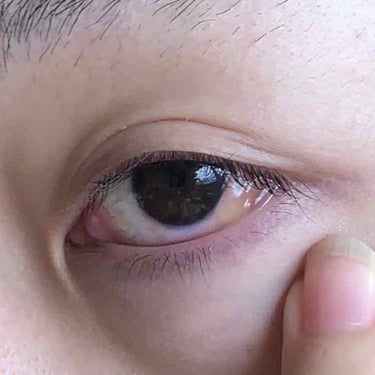 しに子ちゃん on LIPS 「また白目が腫れた。なんかのアレルギーで目がめちゃくちゃ痒くなっ..」（3枚目）