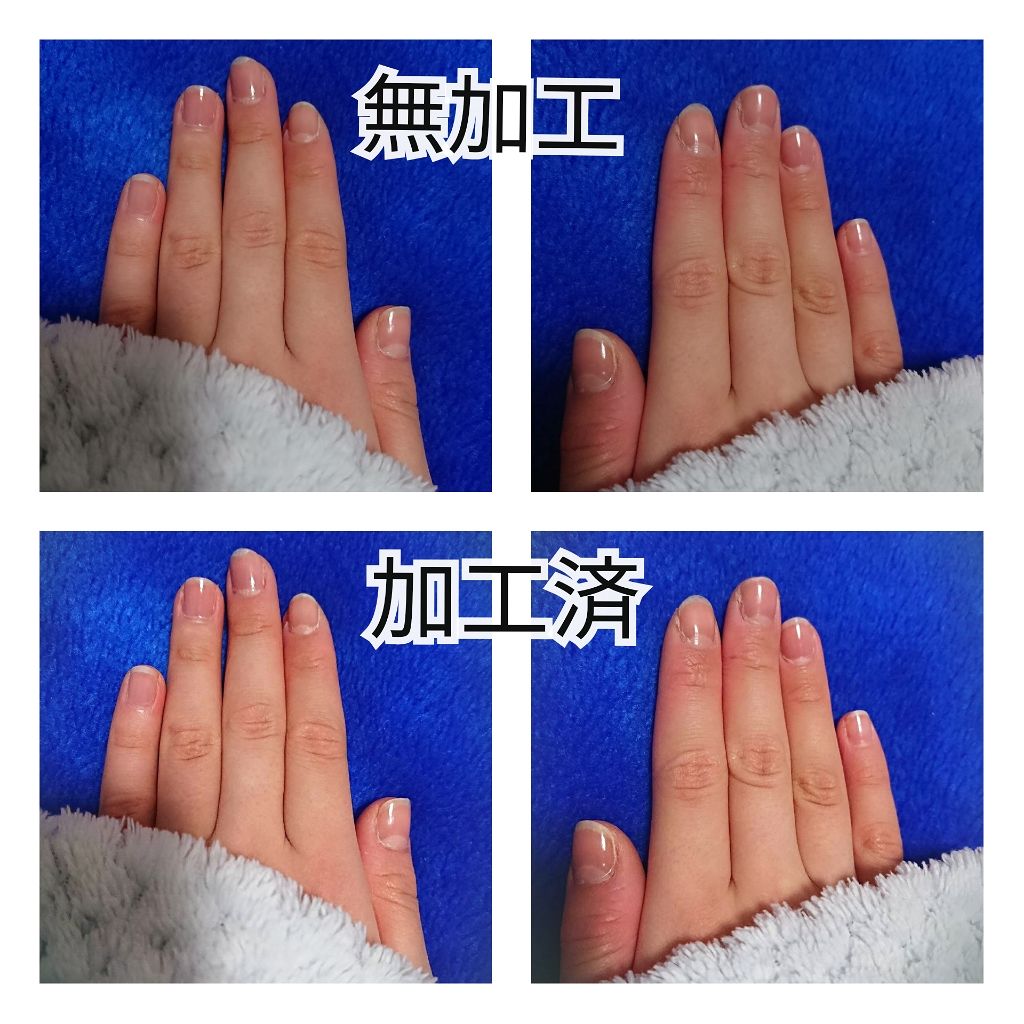 ネイルサポート ピンク/ネイルネイル/ネイルベースコートを使ったクチコミ（2枚目）