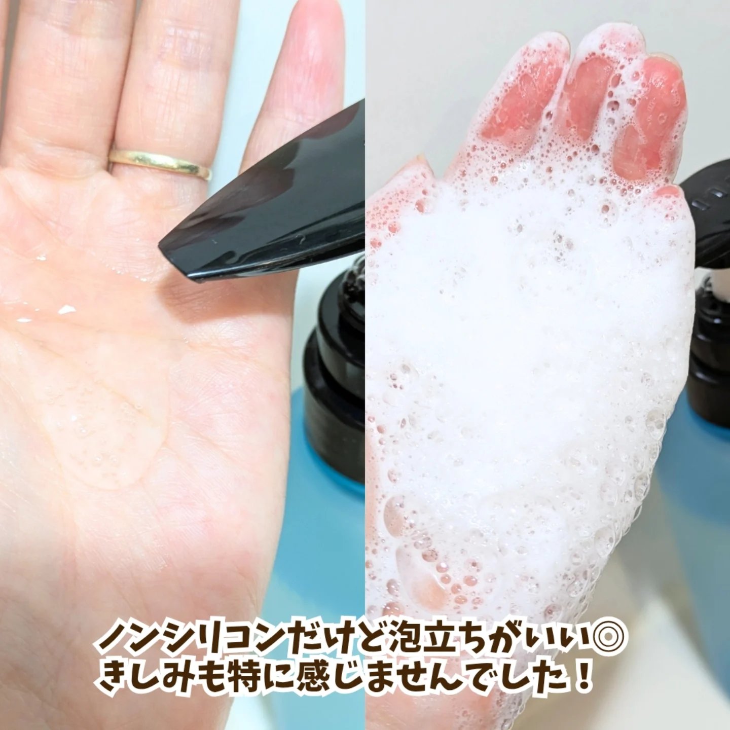 ダメージケアシャンプー/トリートメント　 トリートメント（400ml）/クオリタス/サロンシャンプーを使ったクチコミ（3枚目）