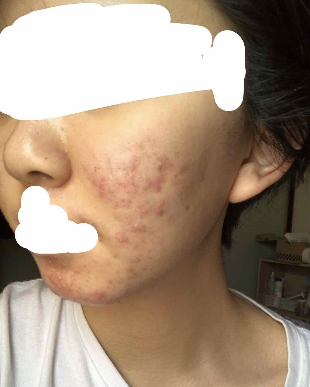 パワーマスク SP/ラッシュ/スクラブ・ゴマージュを使ったクチコミ（1枚目）