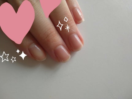 ネイルサポート ピンク/ネイルネイル/ネイルベースコートを使ったクチコミ(2枚目)