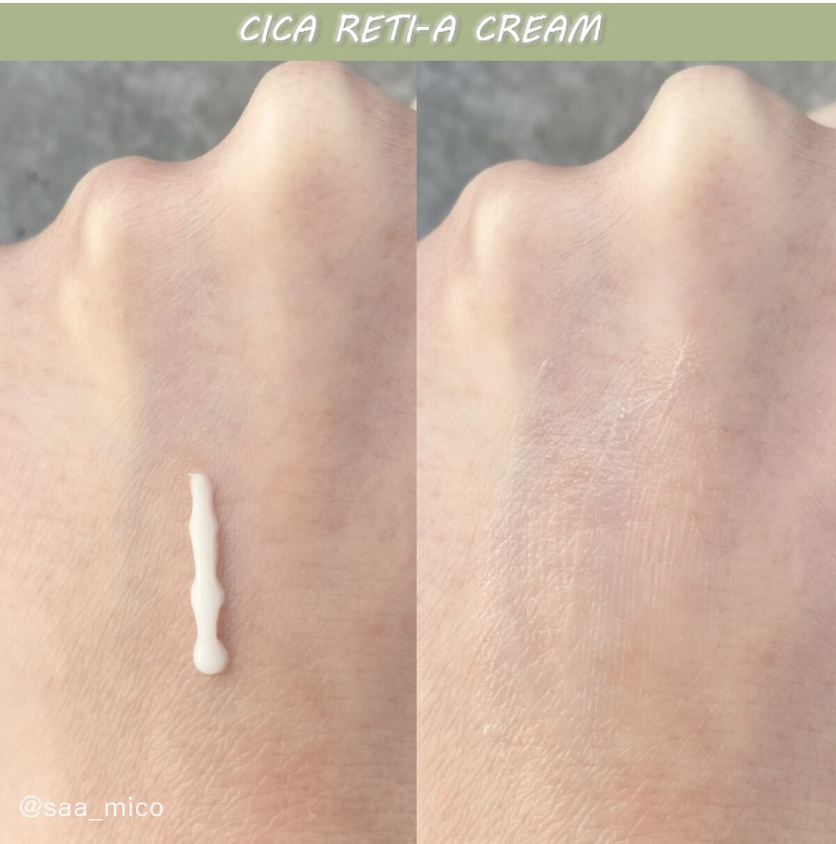 シカレチA エッセンス0.1/VT/美容液を使ったクチコミ（3枚目）