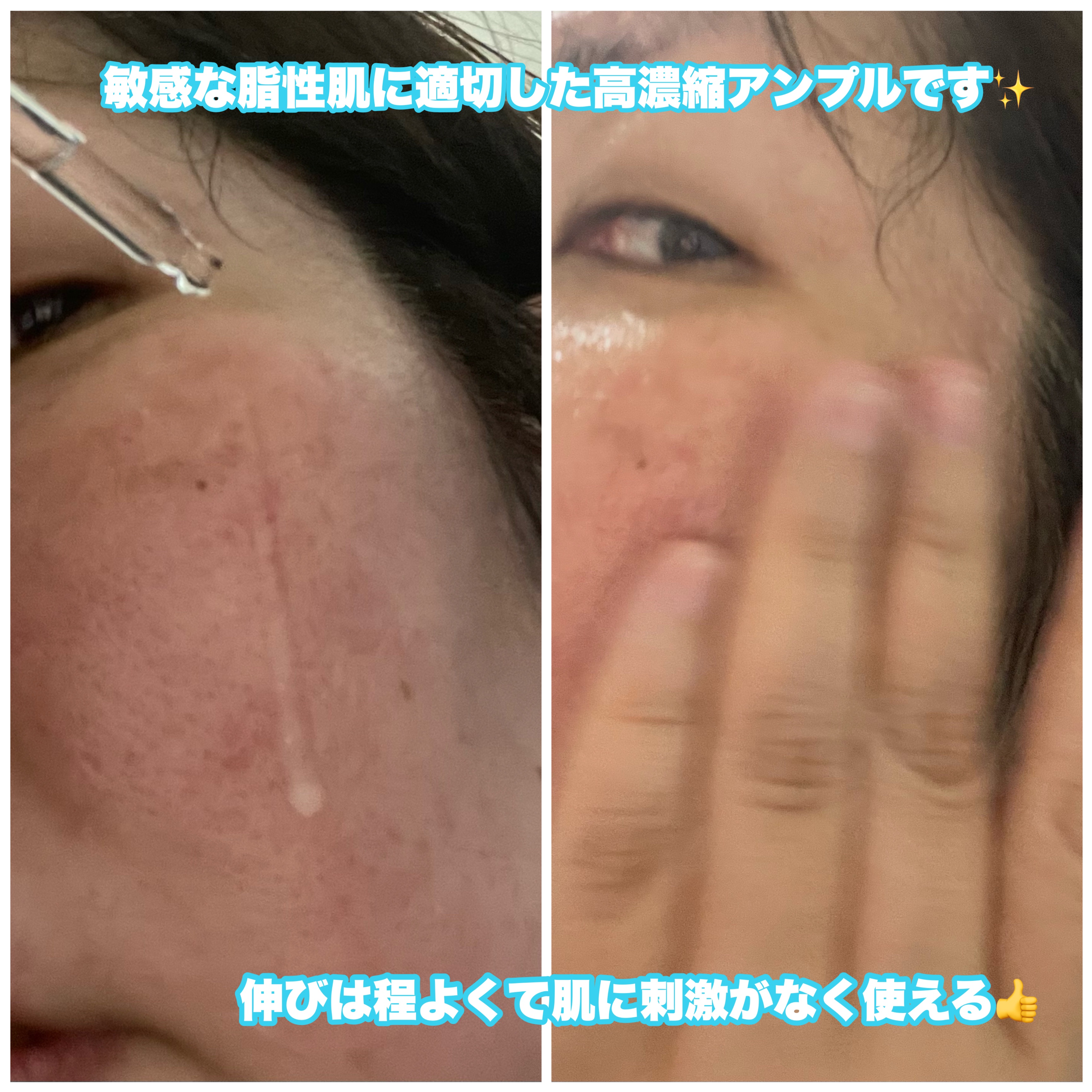 スキンバリアリカバリー131クリーム/Celladix/フェイスクリームを使ったクチコミ（2枚目）