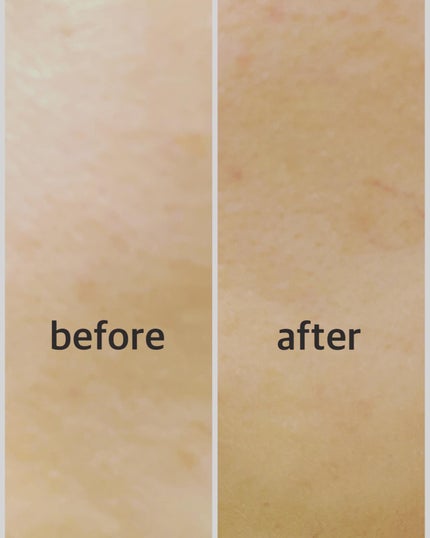 Carrie125 on LIPS 「VT肌レスキュー隊 第2期に応募させていただき、素敵な商品を当..」(9枚目)