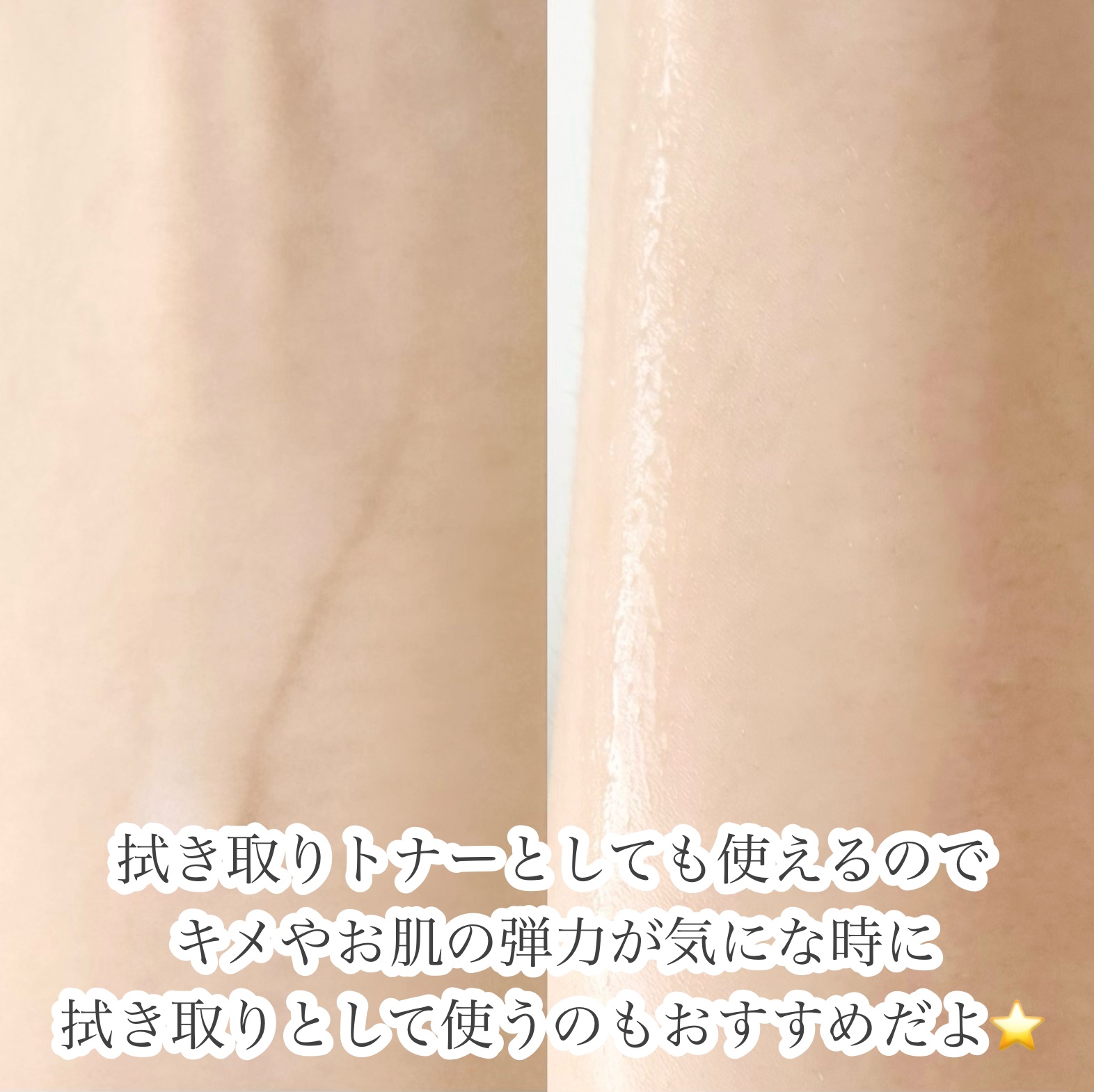 Wonder Ceramide Mochi Toner（トニーモリーワンダーCモチトナー）/TONYMOLY/化粧水を使ったクチコミ（3枚目）