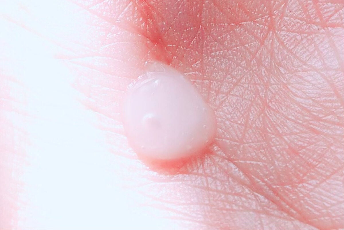 エッセンシャル アクアセラム/ロベクチン/美容液を使ったクチコミ(4枚目)