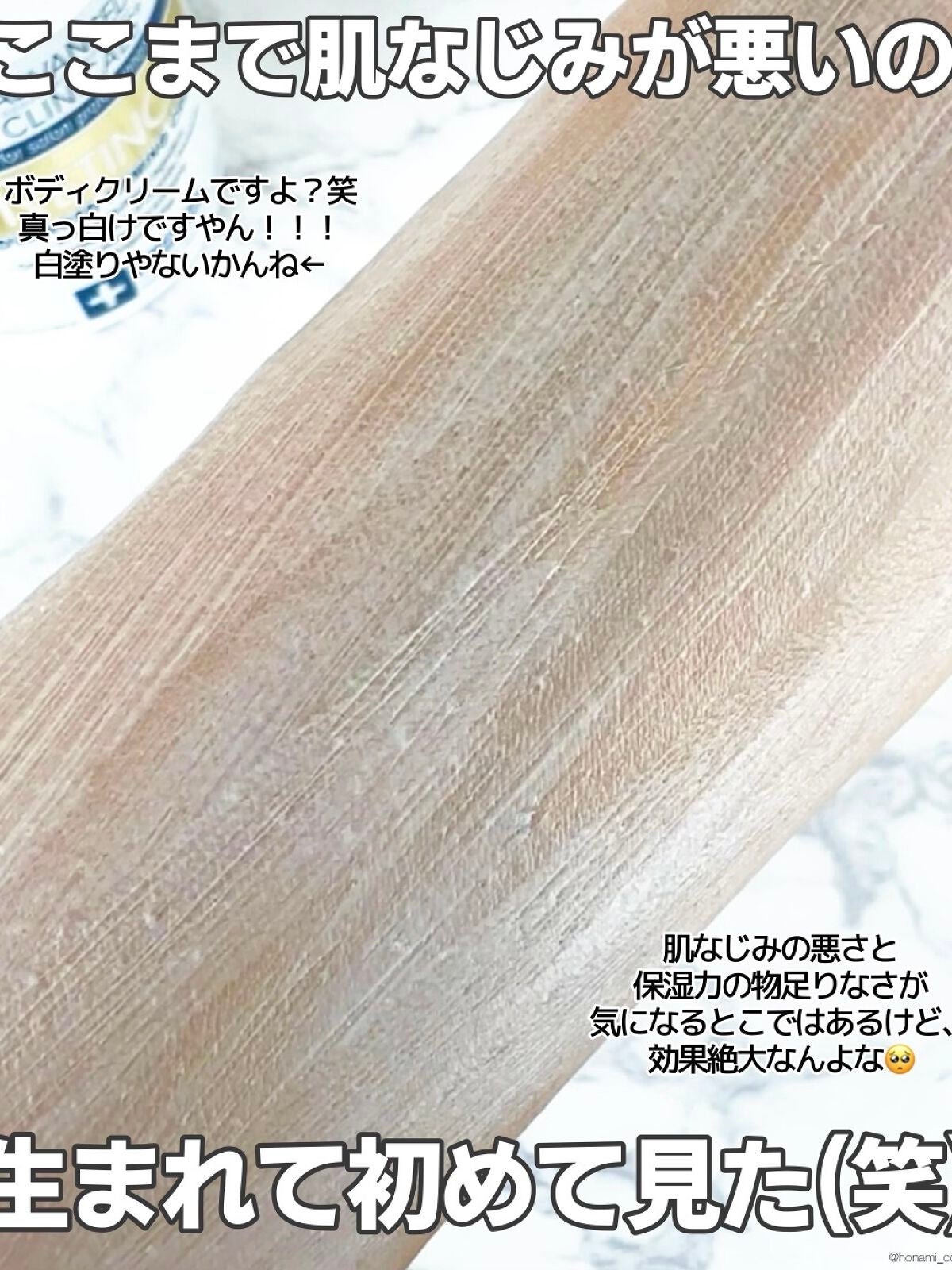 レチノールアドバンスドファーミングクリーム/ADVANCED CLINICALS/ボディクリームを使ったクチコミ(6枚目)