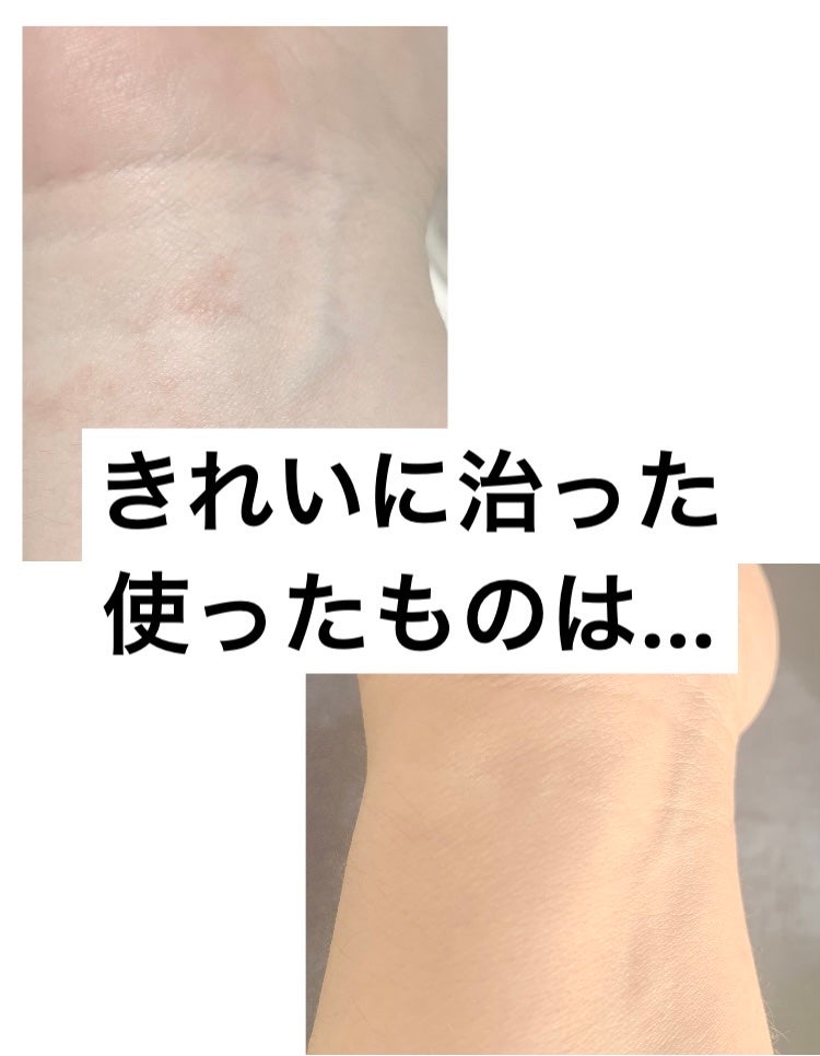 ワセリン/大洋製薬/ボディクリームを使ったクチコミ(1枚目)