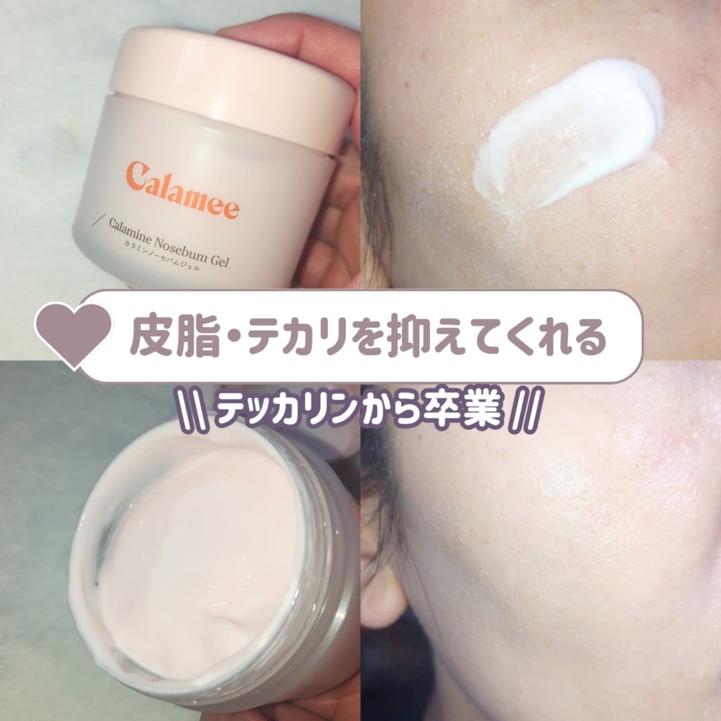 カラミー カラミンノーセバムジェル/Calamee/フェイスクリームを使ったクチコミ(1枚目)