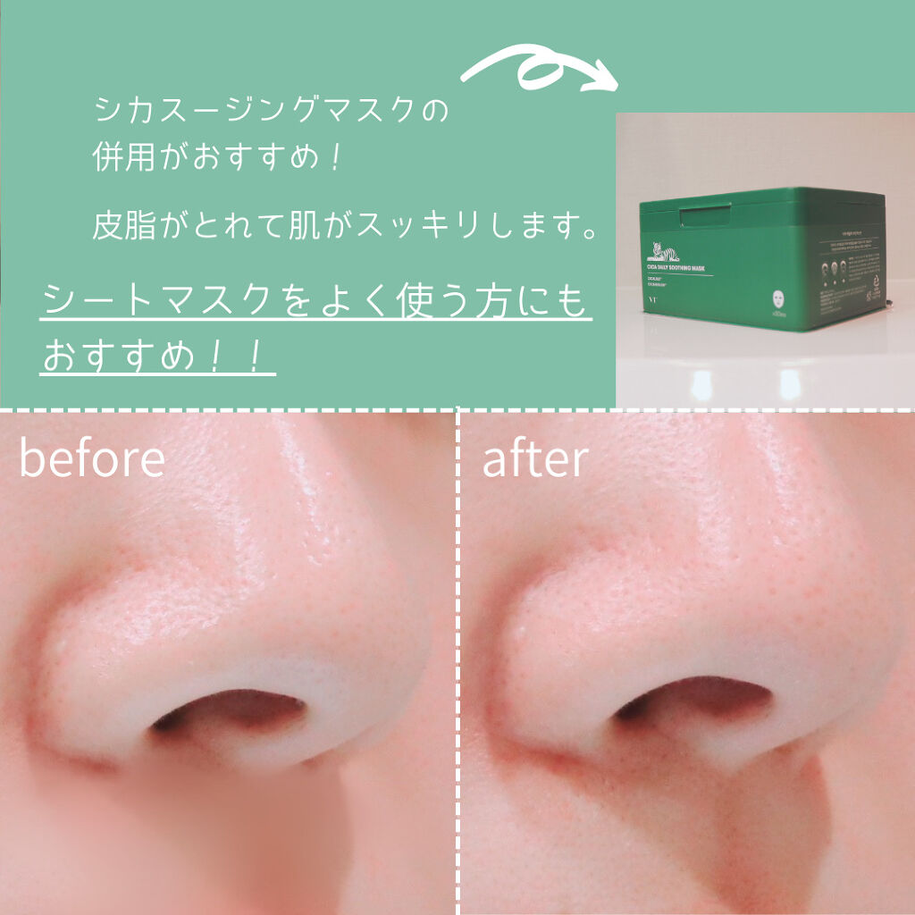 CICA バブルスパークリングブースター/VT/洗い流すパック・マスクを使ったクチコミ（3枚目）