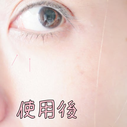 プロバイオシカ インテンシブ アンプル/SKIN1004/美容液を使ったクチコミ(5枚目)