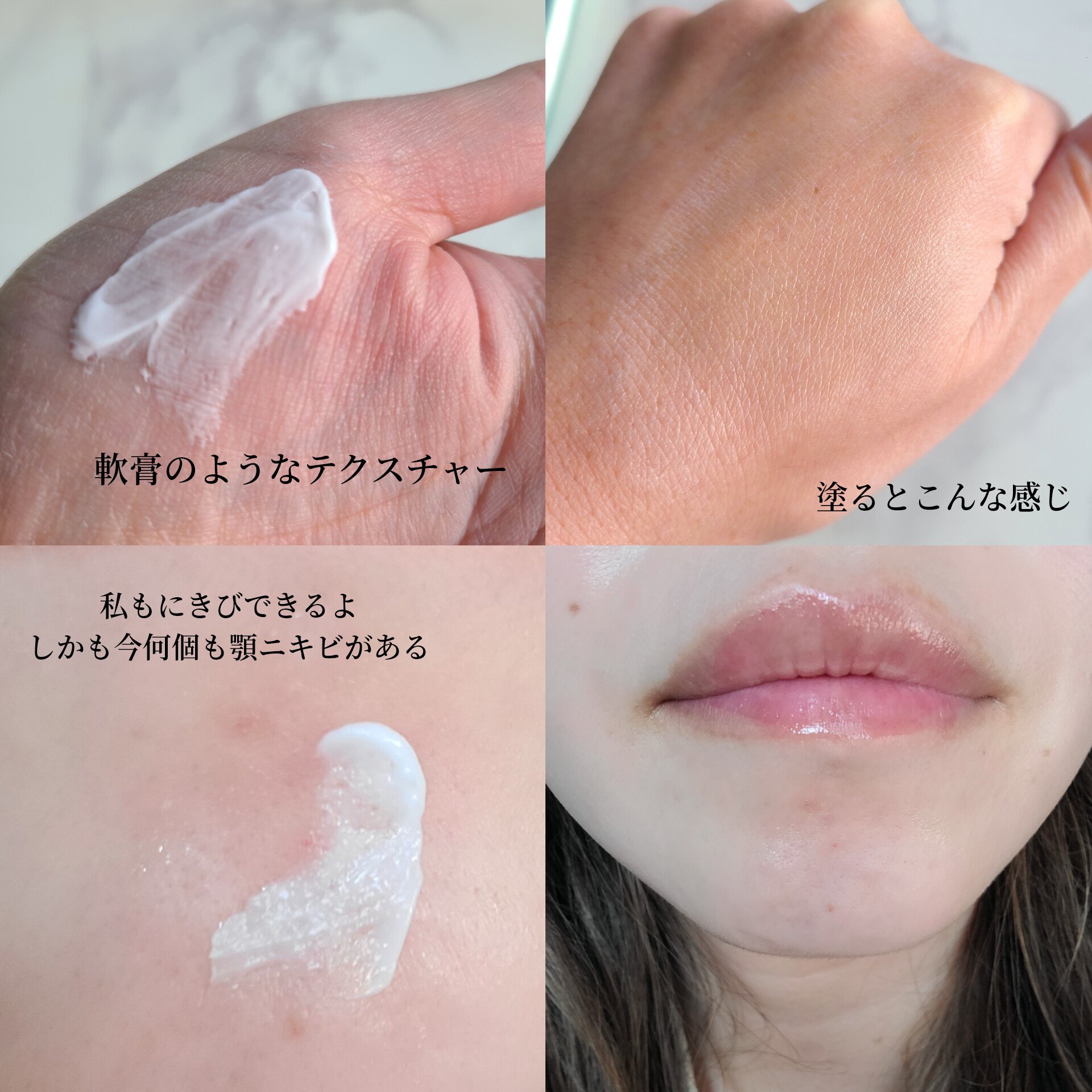 ダーマセプトRX　AZAセラム/ダーマセプトRX/美容液を使ったクチコミ（3枚目）