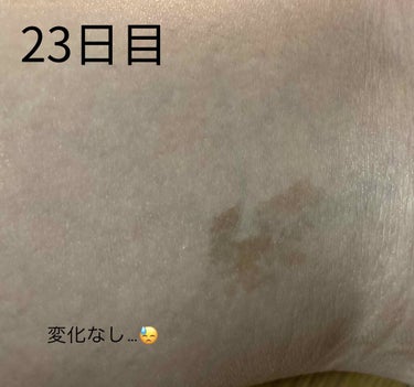 さ様 on LIPS 「使い始めて20日以上経ちました。毎日欠かさず行ってますが、初日..」（1枚目）