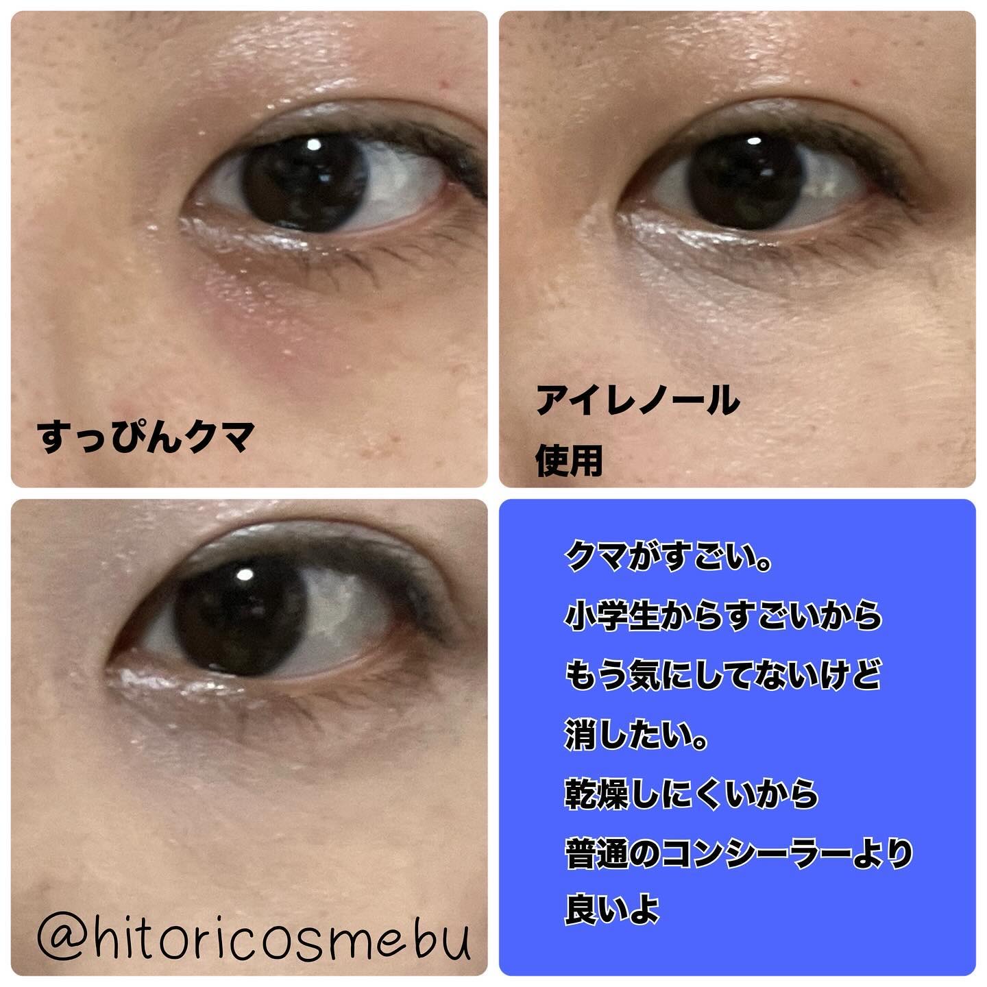 アイレノール クマクリーム/IRENOL/アイケア・アイクリームを使ったクチコミ（3枚目）