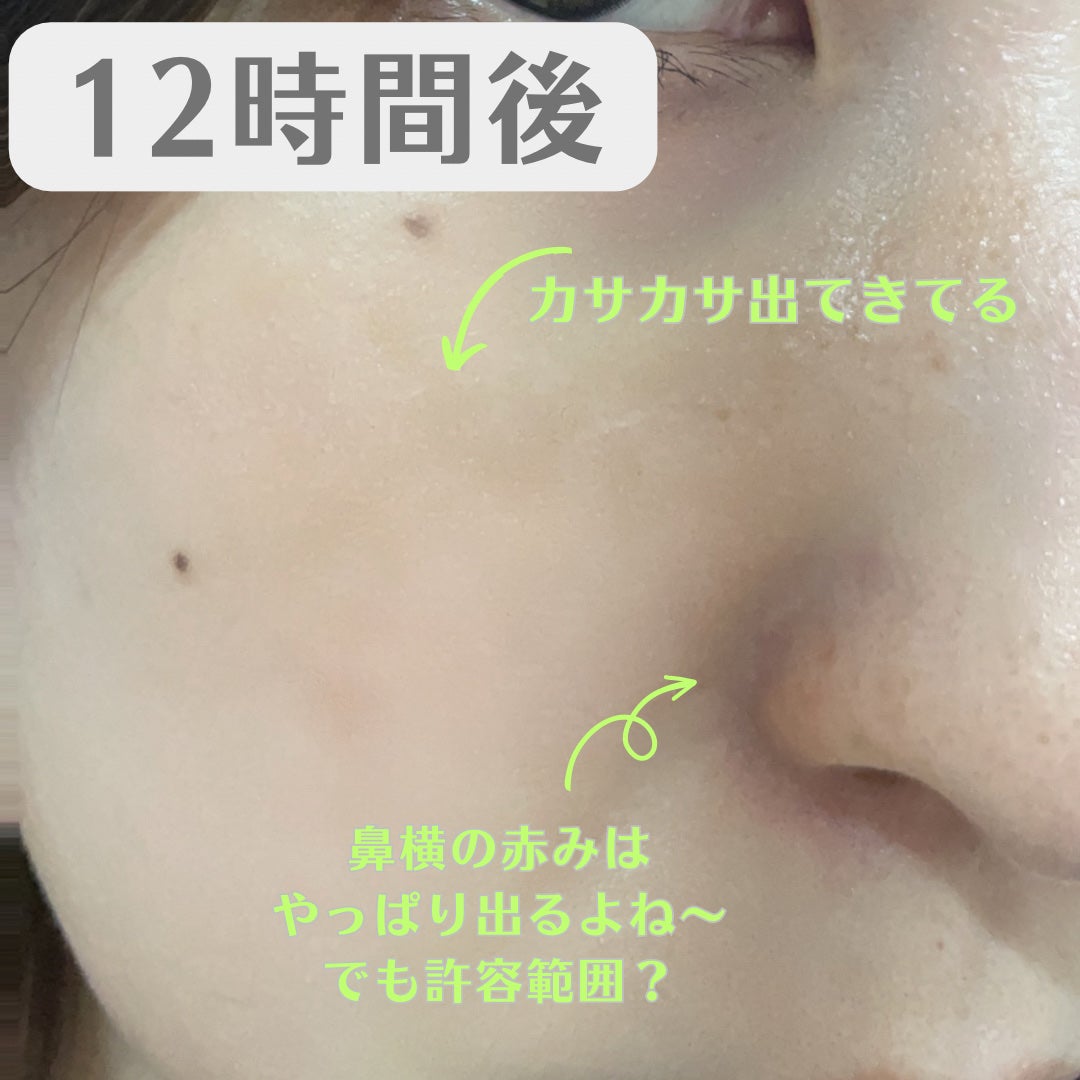 ジャビンドゥソウル ウインクファンデーションパクト/Javin De Seoul/クッションファンデーションを使ったクチコミ(5枚目)