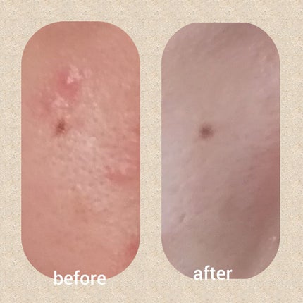 トラブルリペア リキッド/アルージェ/美容液を使ったクチコミ(2枚目)