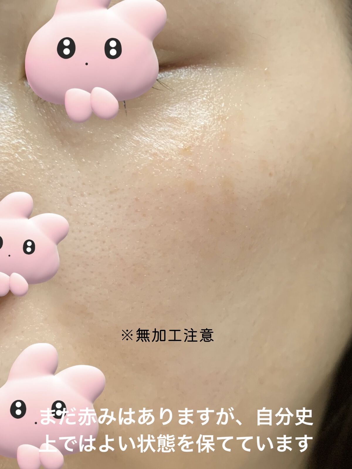 潤浸保湿 泡洗顔料/キュレル/泡洗顔を使ったクチコミ（2枚目）