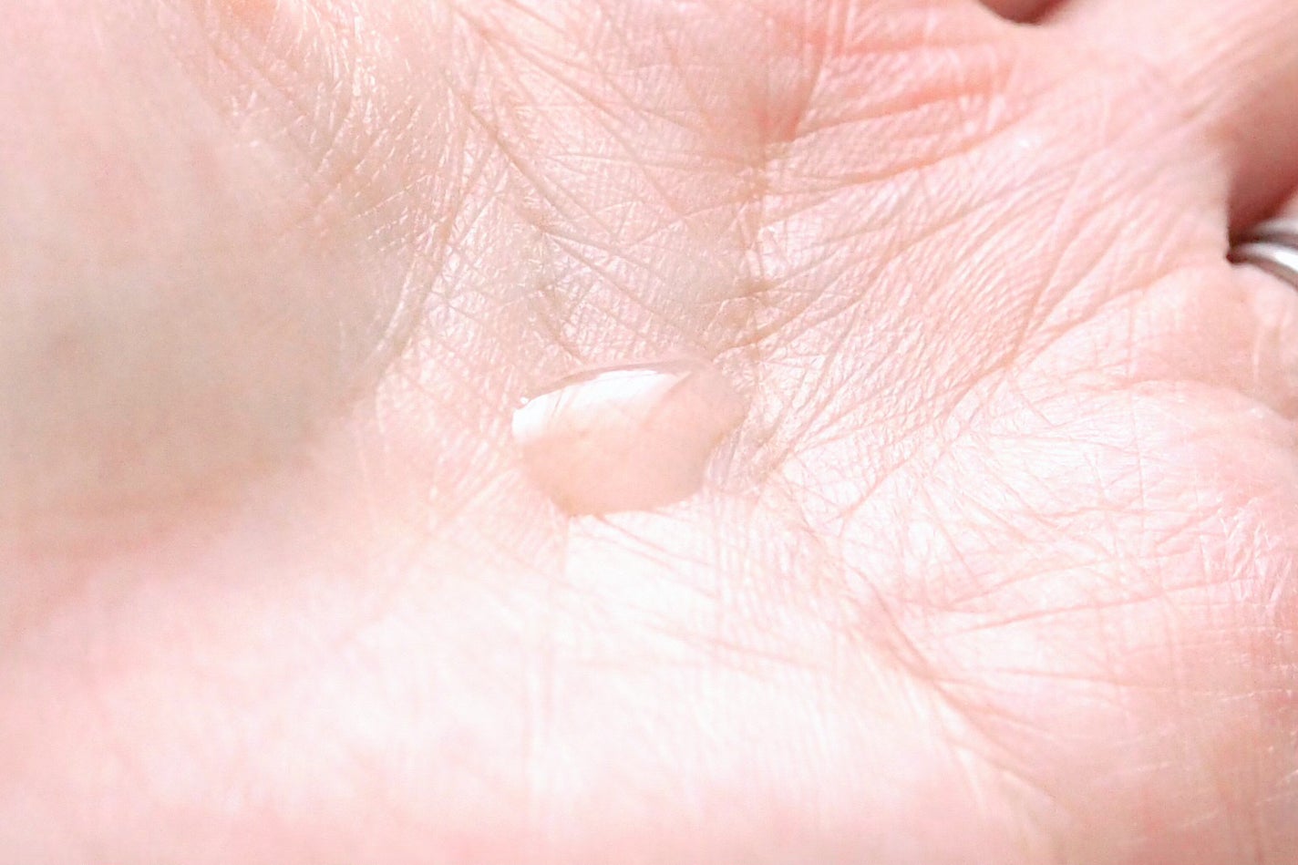 モイスチュアマイルドホワイトリペアエッセンス C100/モイスチュアマイルド ホワイト/美容液を使ったクチコミ(4枚目)