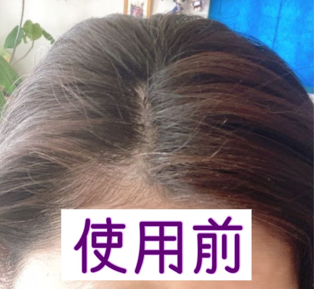 エクセランス R クリームタイプ /ロレアル パリ/ヘアカラーを使ったクチコミ（2枚目）