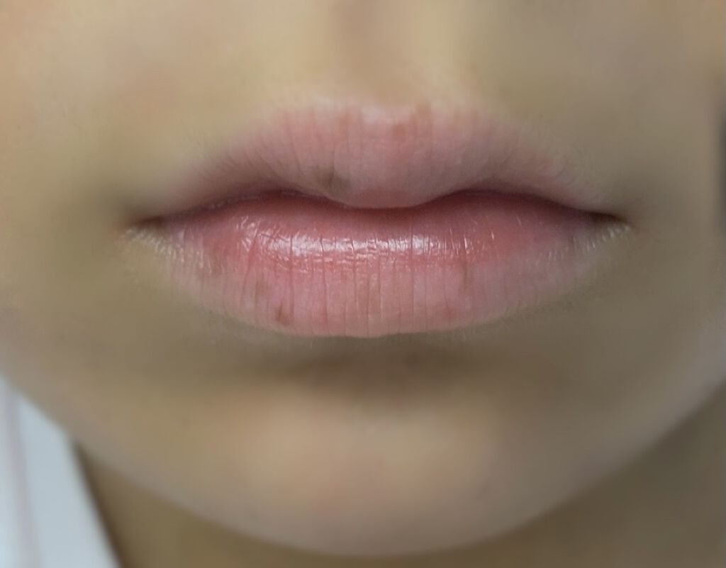 エテュセ リップエディション（プランパー）リッチスタイル/ヘルシースタイル/ettusais/リップケアを使ったクチコミ（2枚目）