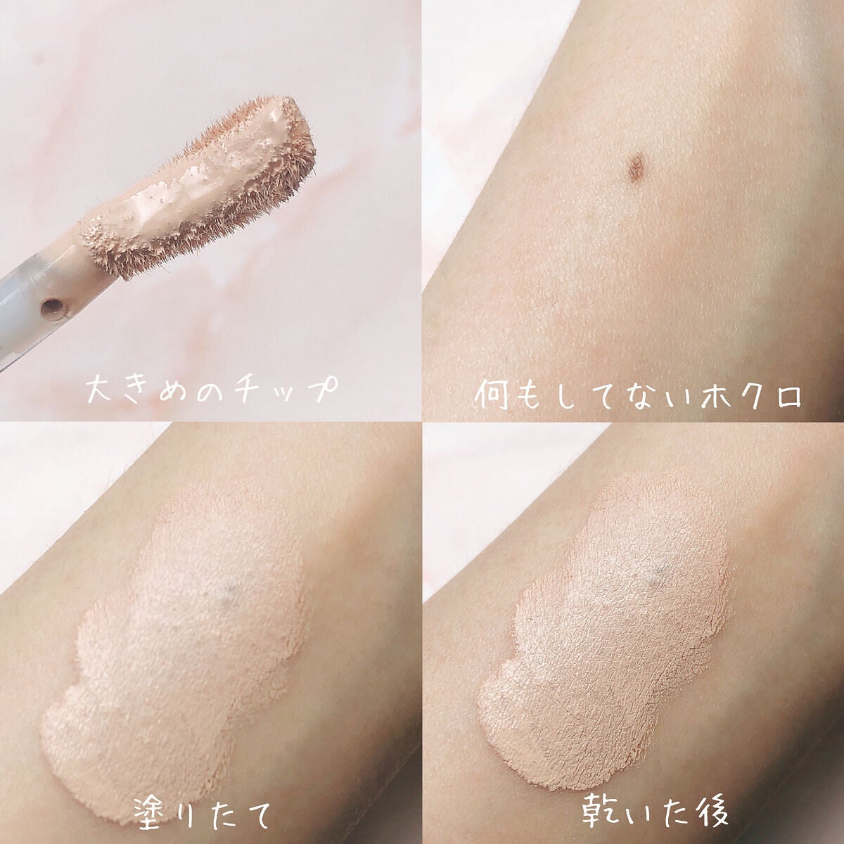 タトゥーウォータープルーフスカーコンシーラー/フォレンコス/リキッドコンシーラーを使ったクチコミ(2枚目)