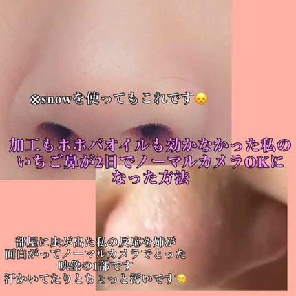 ベビーオイル 無香料/ジョンソンベビー/ボディオイルを使ったクチコミ(1枚目)