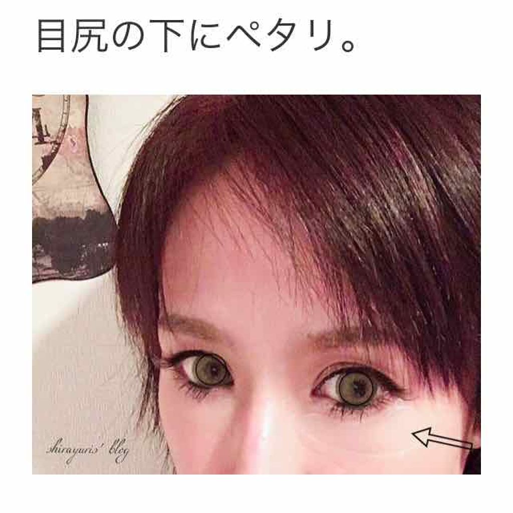 HA フィルパッチ B/ナビジョンDR/美容液を使ったクチコミ(4枚目)