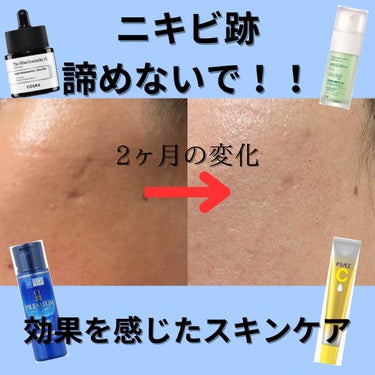 白潤プレミアム薬用浸透美白化粧水/肌ラボ/化粧水を使ったクチコミ（1枚目）