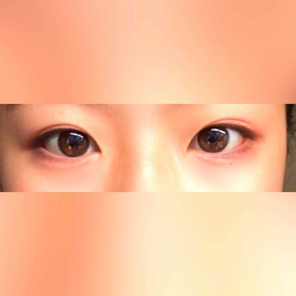 アイビューティー フィクサー WP/アストレア ヴィルゴ/二重まぶた用アイテムを使ったクチコミ(1枚目)