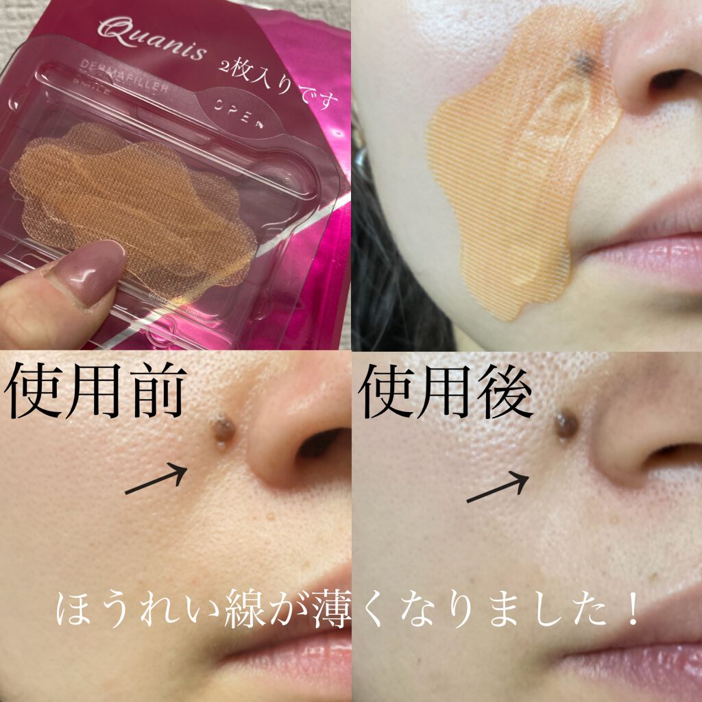 クオニス　ダーマフィラースマイル　 シート状美容液13回分　超お買い得☆ cmq02-21-p081.jpg