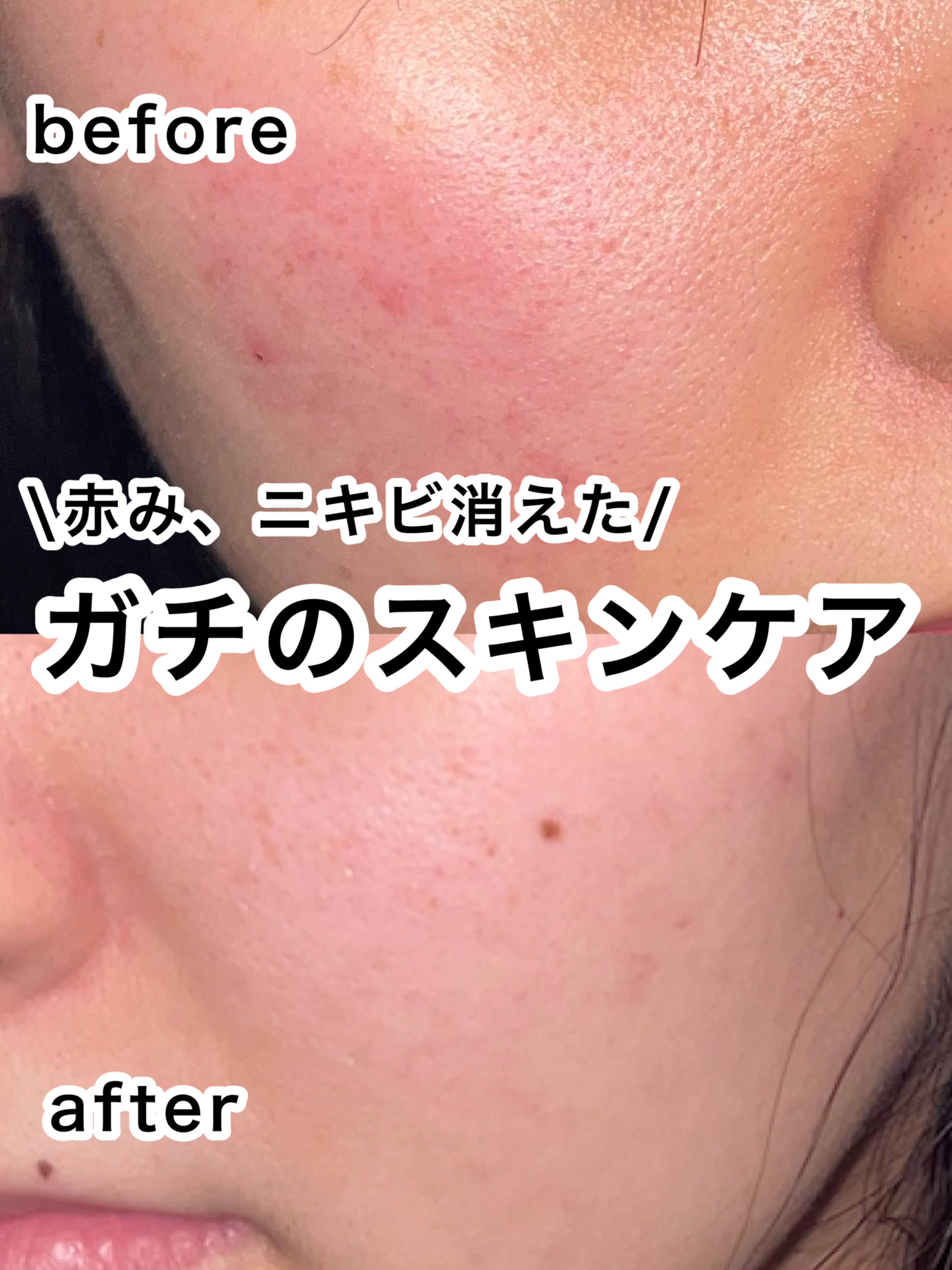 化粧水・敏感肌用・高保湿タイプ/無印良品/化粧水を使ったクチコミ（1枚目）