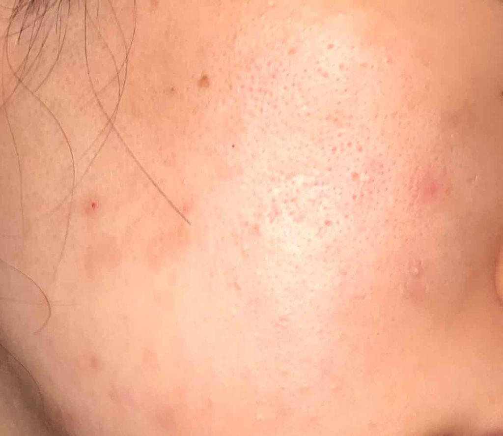 ホルモンクリーム/クラブ/フェイスクリームを使ったクチコミ（3枚目）