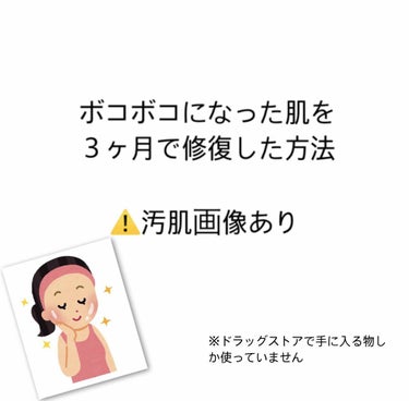 いつかの石けん/水橋保寿堂製薬/洗顔石鹸を使ったクチコミ（1枚目）