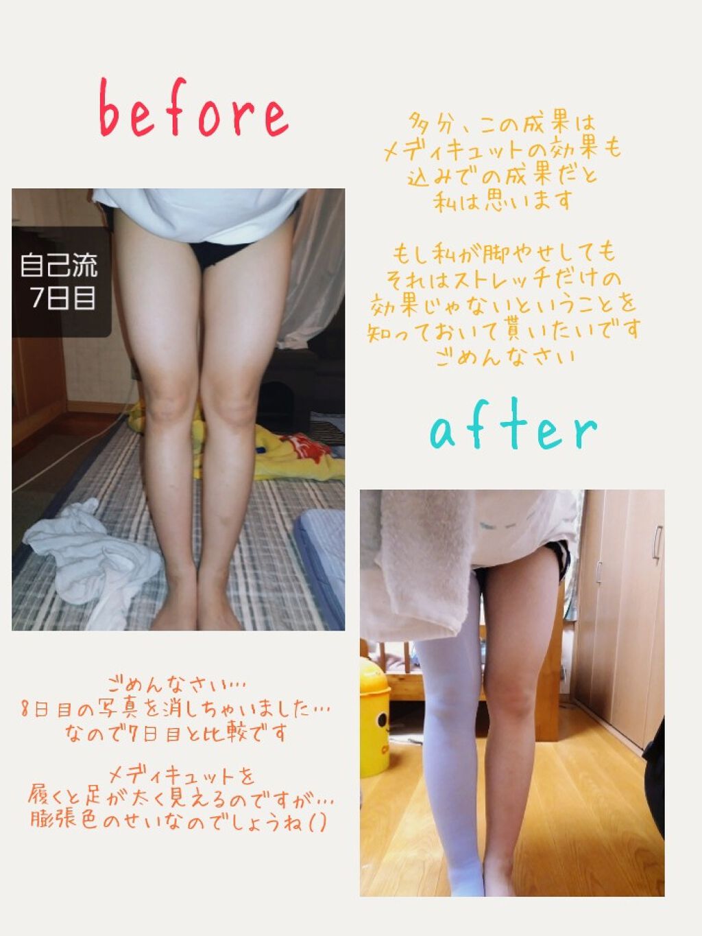 寝ながらメディキュット ロング メディキュットの効果に関する口コミ どうもこんばんは あすです By あす です 10代前半 Lips 寝ながらメディキュット ロング メディキュットの効果に関する口コミ どうもこんばんは あすです By あす です 10代前半 Lips