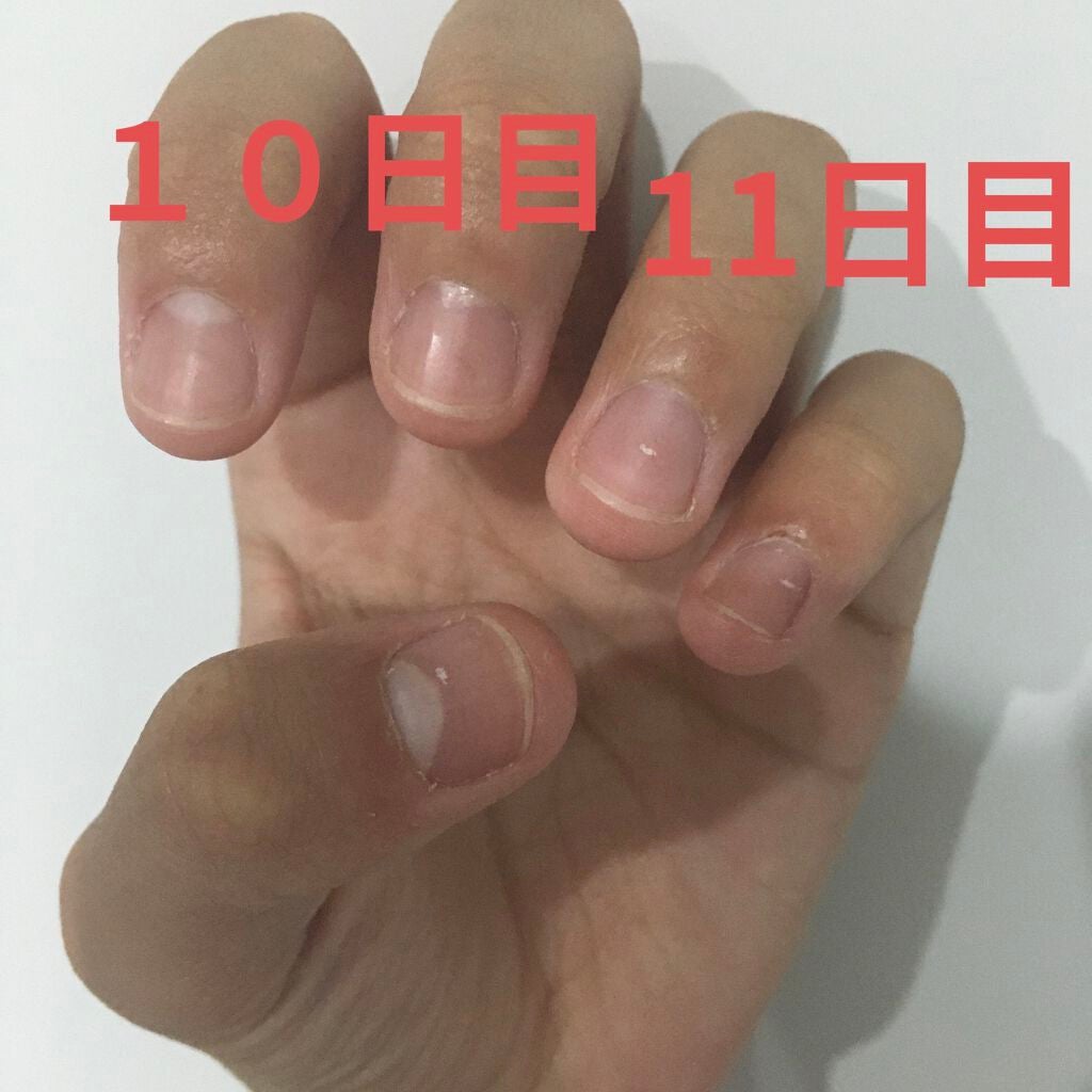 LEMONð on LIPS ãïŒïŒæ¥ç®ã®æçš¿ãã§ããªãã£ãã®ã§11æ¥ç®ãšäžç·ã«æçš¿ããŸãâŒïž..ãïŒ2æç®ïŒ