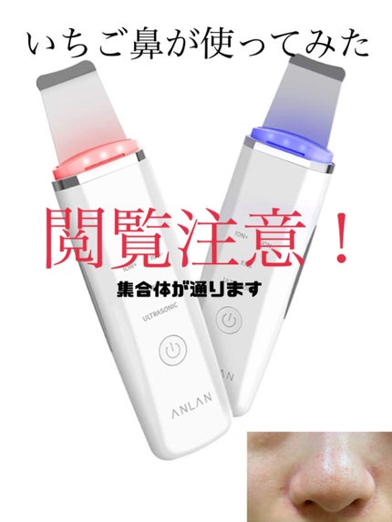 ウォーターピーリング超音波美顔器/ANLAN/美顔器・マッサージを使ったクチコミ(1枚目)