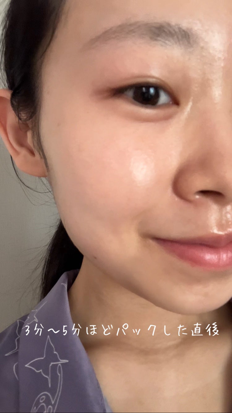 ウォンジョンヨ モイストアップレディスキンパック N/Wonjungyo/シートマスク・パックを使ったクチコミ(4枚目)