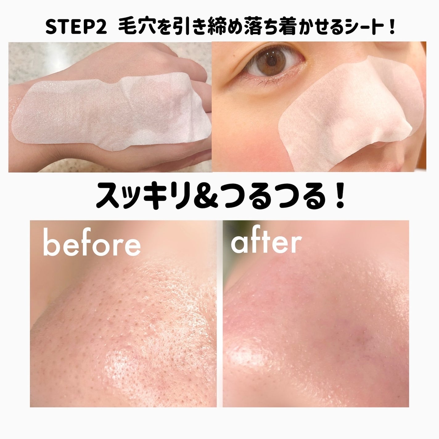 ナチュラルマイルドクリアノーズパック/ilso/シートマスク・パックを使ったクチコミ(6枚目)