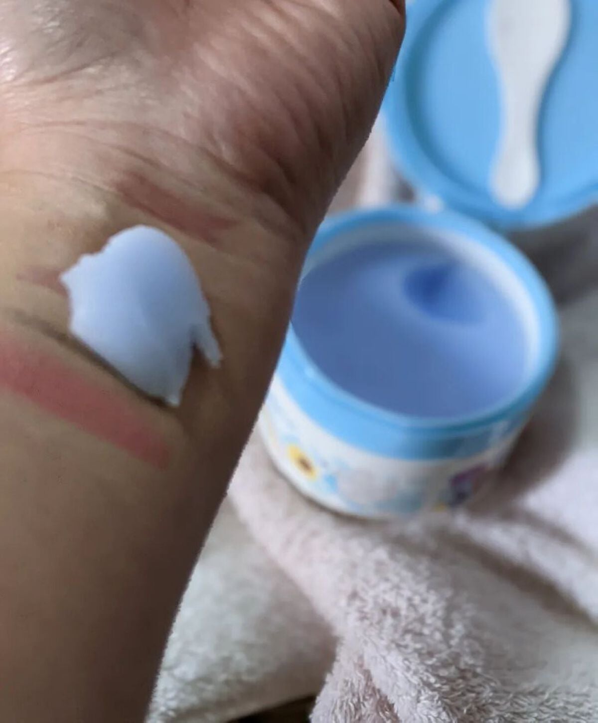 夢みるバーム アクネクリアモイスチャー/ロゼット/クレンジングバームを使ったクチコミ(4枚目)