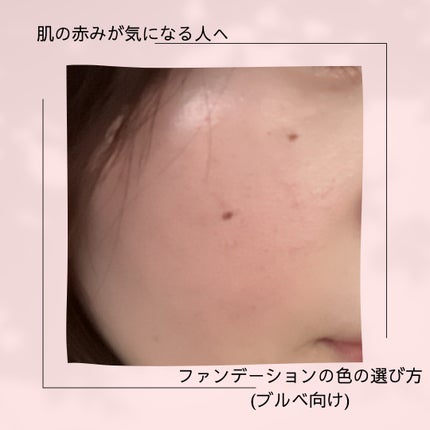 フィットミー リキッド ファンデーション DN/MAYBELLINE NEW YORK/リキッドファンデーションを使ったクチコミ(1枚目)