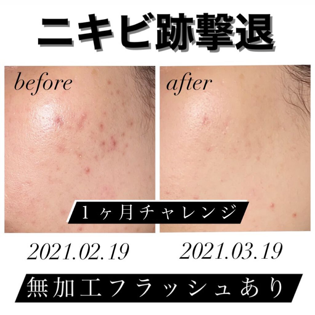 ドクタージャルト シカペア クリーム （第2世代）｜Dr.Jart＋の口コミ